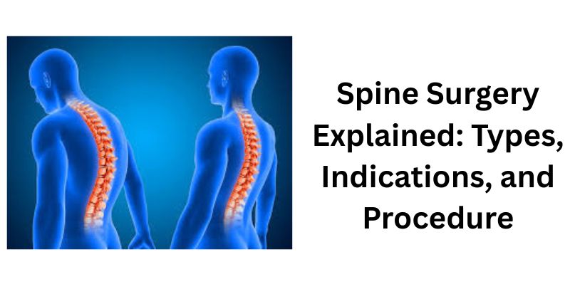 1744011746-Spine_Surgery_Explained_Types,_Indications,_and_Procedure.jpg