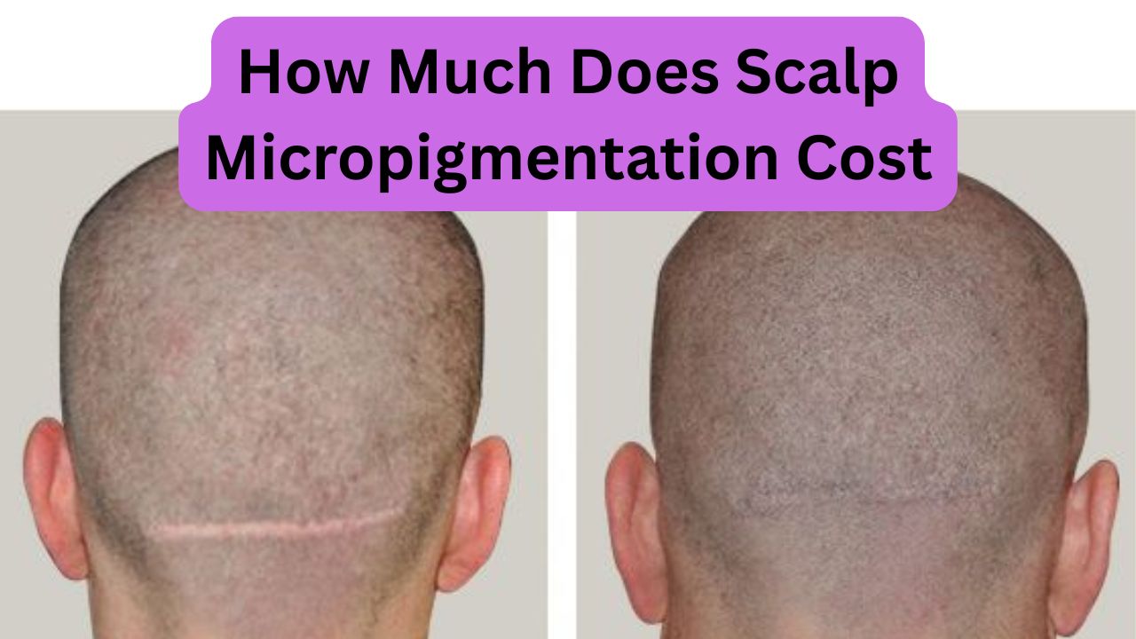 1747130250-How_Much_Does_Scalp_Micropigmentation_Cost.jpg