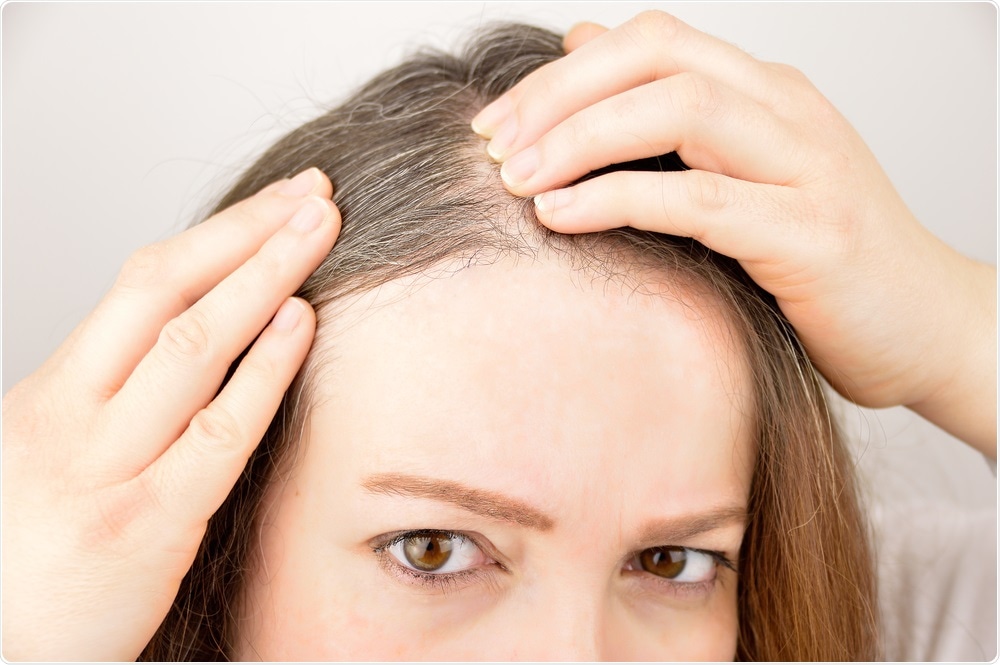 1748245035-Boost_Your_Hair_Growth_with_PRP_and_Laser_Therapy.jpg