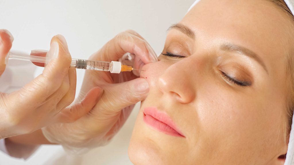 1748323290-Cheek_Fillers.jpg