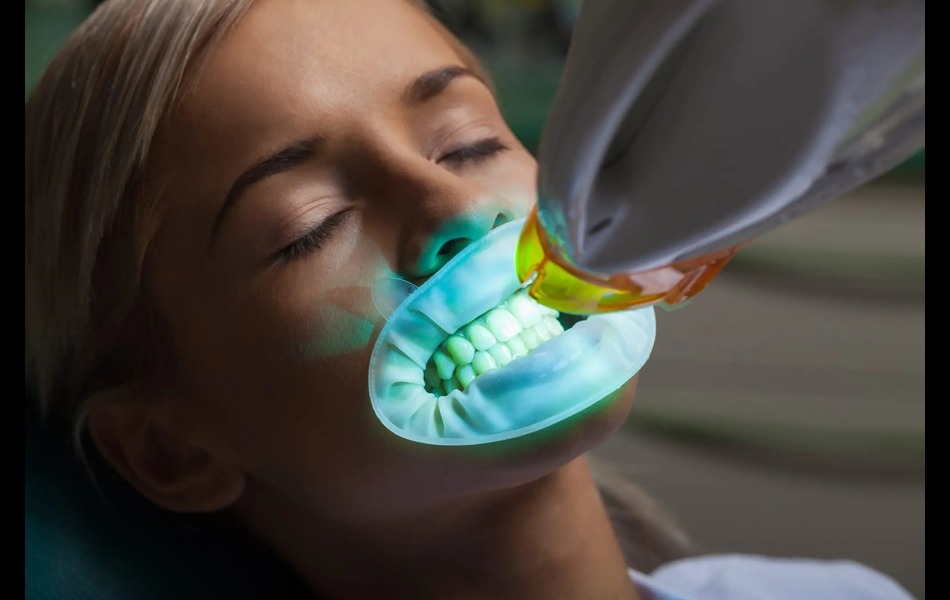 1748589862-teeth_whitening_service_in_lamiradadentists.jpg
