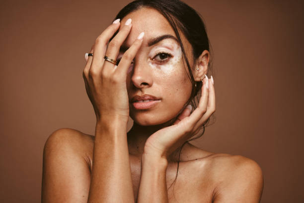1749633820-How_Effective_Is_Vitiligo_Treatment.jpg