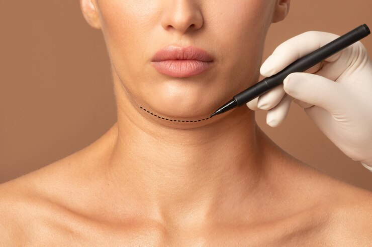 1750054235-Is_Chin_Liposuction_Worth_It.jpg