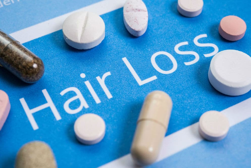 1750932290-Hair-Loss-Tablets.jpg