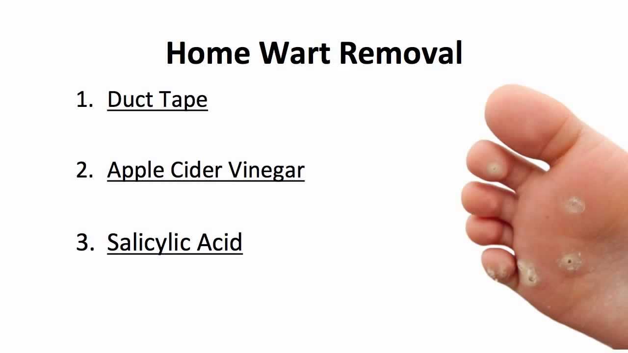 1753781317-wart_removal_leeds.jpg