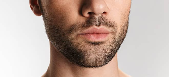 1753865878-What’s_the_Downtime_After_Beard_Hair_Transplant.jpg