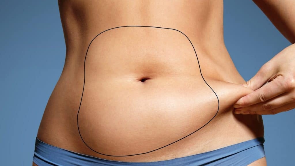 1754996399-Liposuction_in_Dubai_for_Stubborn_Belly_Fat.jpg