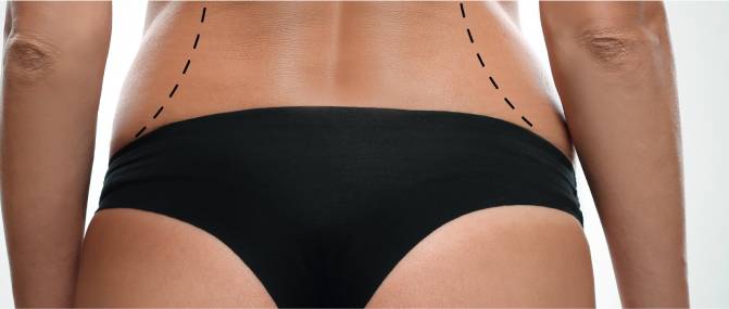 1756176818-body-contouring-pic02.jpg