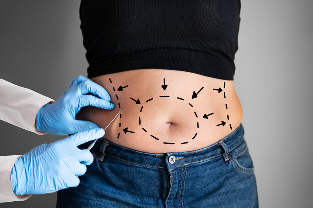 1760078235-Body_contouring_in_Riyadh.jpg